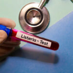 A gloved hand holding a blood test tube labeled 'Listeria - Test'