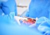 Surgeons in blue scrubs handling an organ during surgery