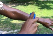FDA Finally Blinks on Sunscreen What to know about the FDA's newly approved sunscreen ingredient