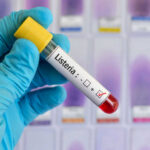 Listeria Alert Hits Deli Favorites Listeria positive test tube