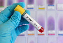 Listeria Alert Hits Deli Favorites Listeria positive test tube