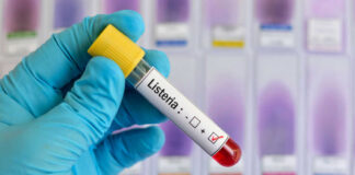 Listeria positive test tube
