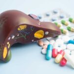 Miracle Pill Impacts Deadly Cancer An anatomical model of a liver surrounded by various pills and medications